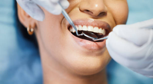 Best Emergency Tooth Extraction in Bressler, PA